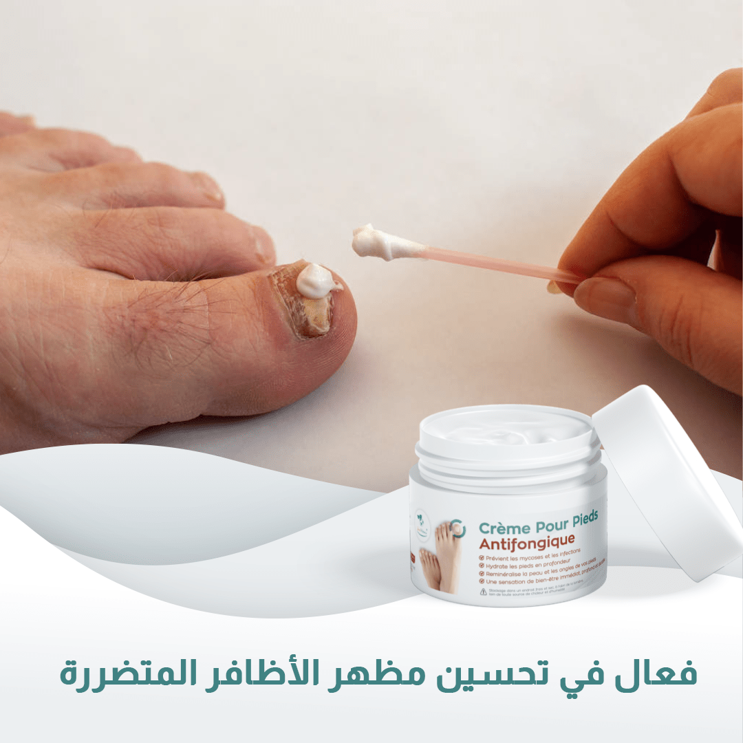 Crème Antifongiques 90gr - Nour Pharma