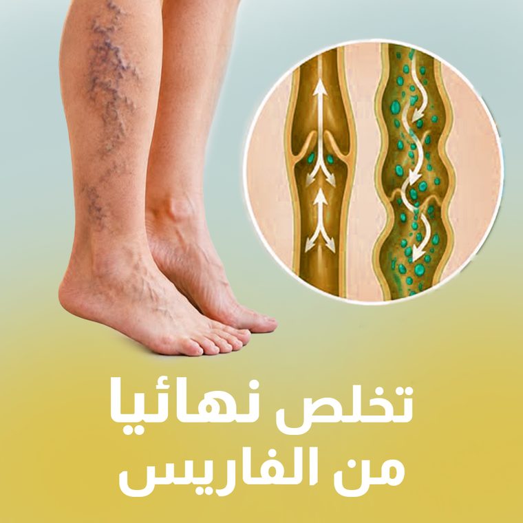 Gel Anti-Varices 90gr - Nour Pharma