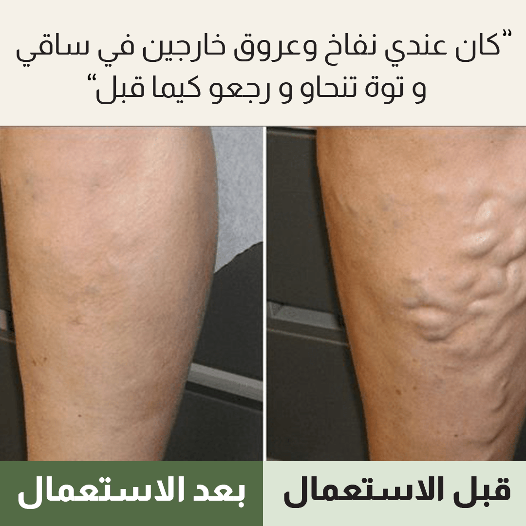 Gel Anti-Varices 90gr - Nour Pharma