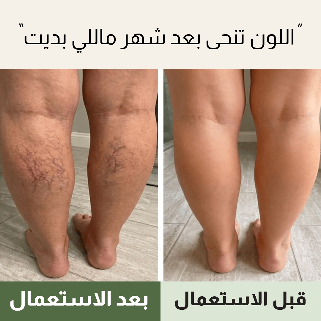 Gel Anti-Varices 90gr - Nour Pharma